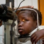 Kadiguetas Augen werden mithilfe eines Gerätes untersucht. Die Augen des Mädchens werden mit einem Licht beschienen, während sie sich auf die Untersuchung konzentriert.