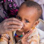 Mädchen bekommt ein Antibiotika gegen die Infektionskrankheit Trachom in flüssiger Form in einem kleinen Becher verabreicht