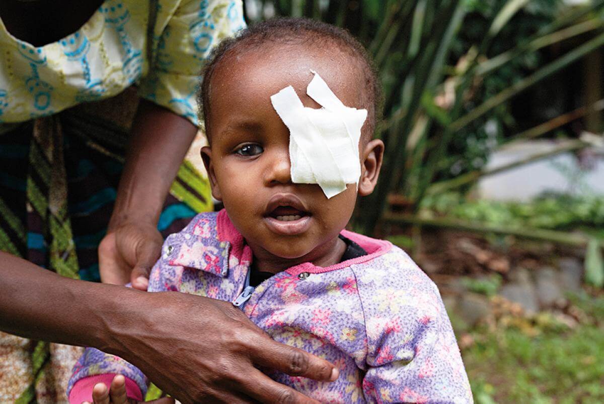 Ein Kind mit einem Verband am rechten Augen blickt in die Kamera. Es wird von seiner Mutter aufrecht gehalten.