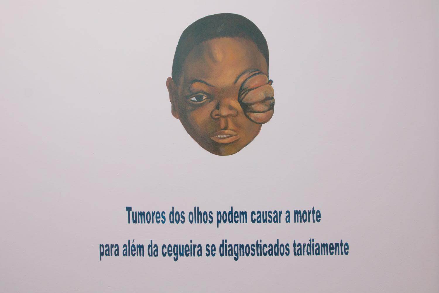 Aufklärende Malerei in der Augenklinik Quelimane, Mosambik.