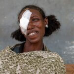 Auf dem Bild ist eine Frau mit einem Verband um das linke Auge zu sehen. Sie lacht und ist glücklich. Gerade wurde sie wegen der Augeninfektion Trachom operiert, die ihr Augenlicht gerettet hat.