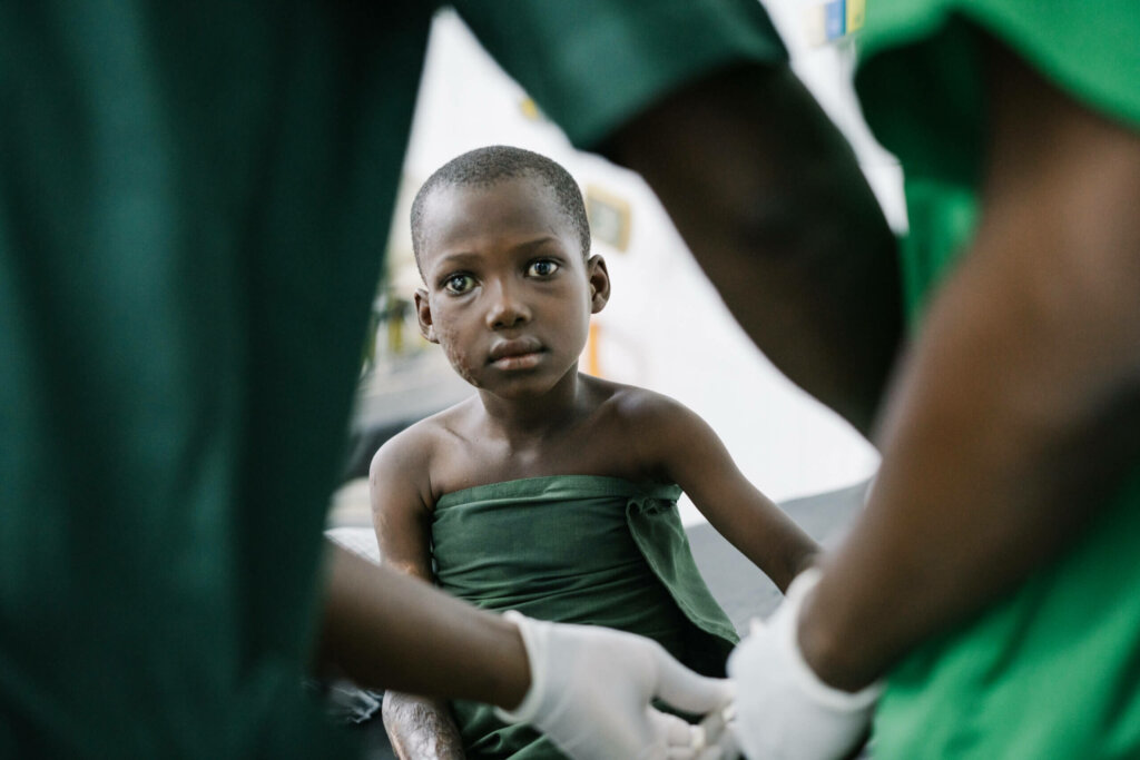 Boy sitting and staring right at the camera with a cataract and a detached retina on the left side of his face. He is wearing a green hospital gown and two doctors with green uniforms are approaching him, ready to start his operation.