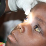 Header image for article featuring a close-up of a child's face as their eyes are examined