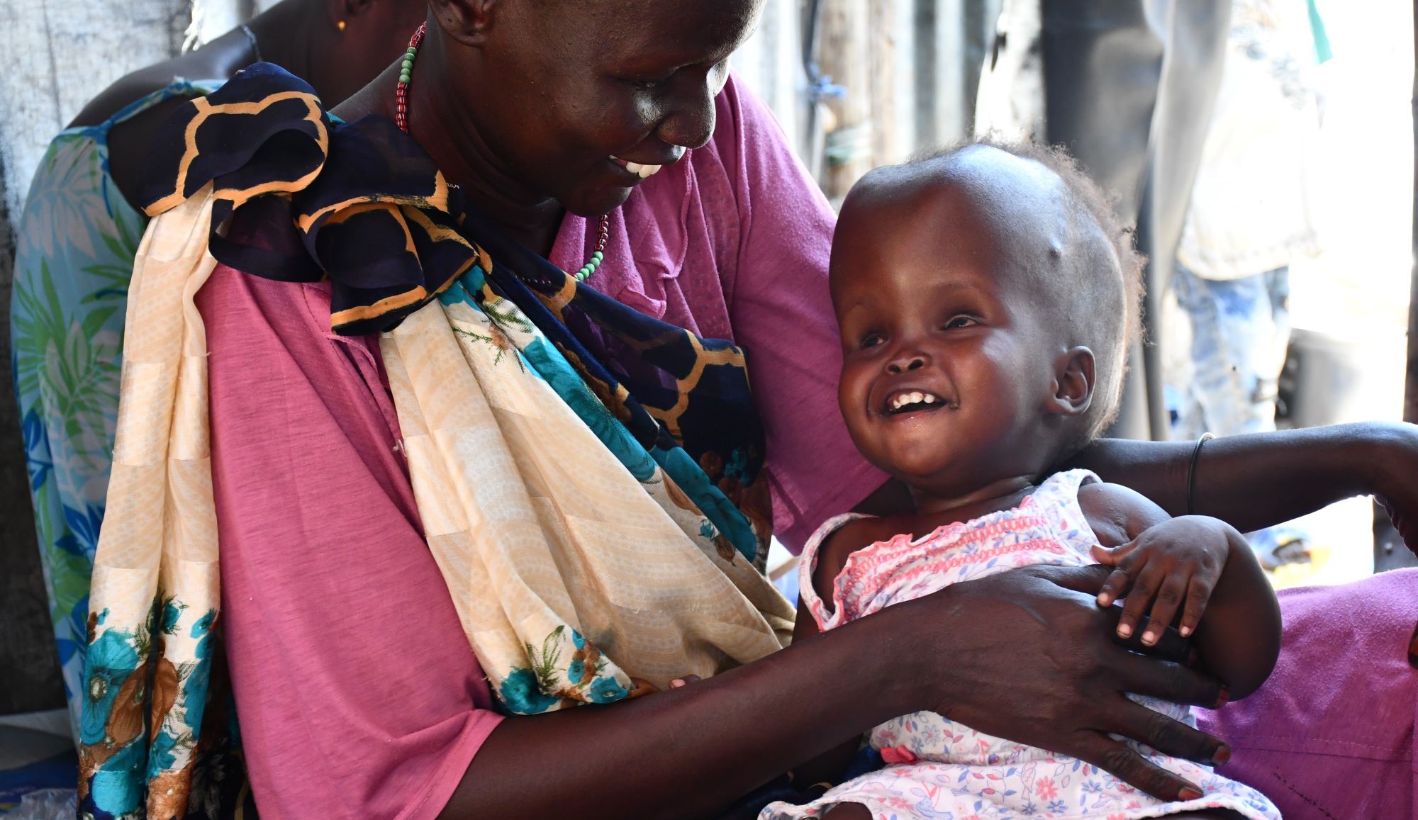 Image of Nyakhan James, a one-year-old refugee with hydrocephalus, being held by her aunt Elizabeth Nyaper.