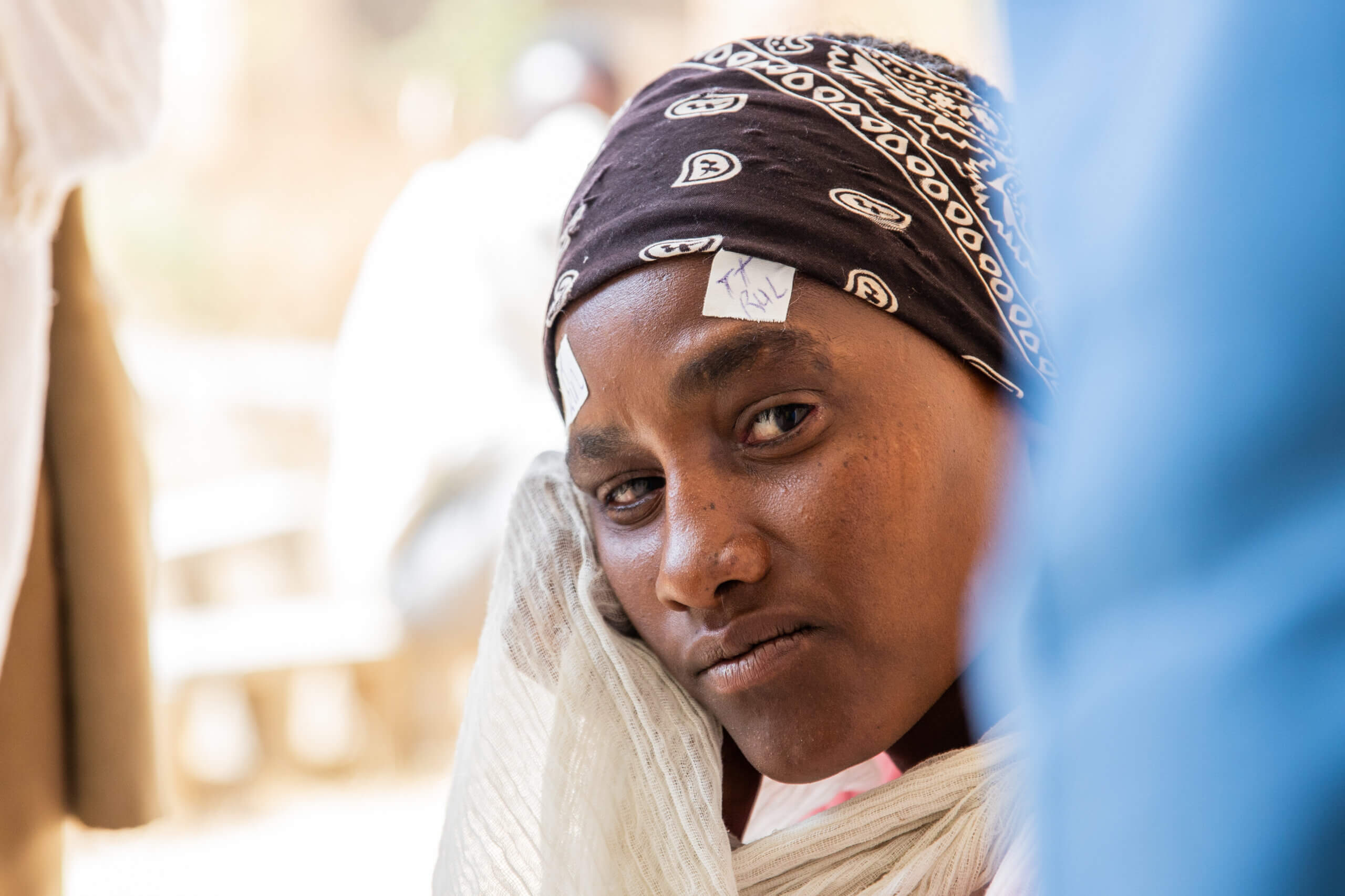 A woman looks at the camera. She has two bandages over each eyebrow and is wearing a black and white patterned scarf on her head.