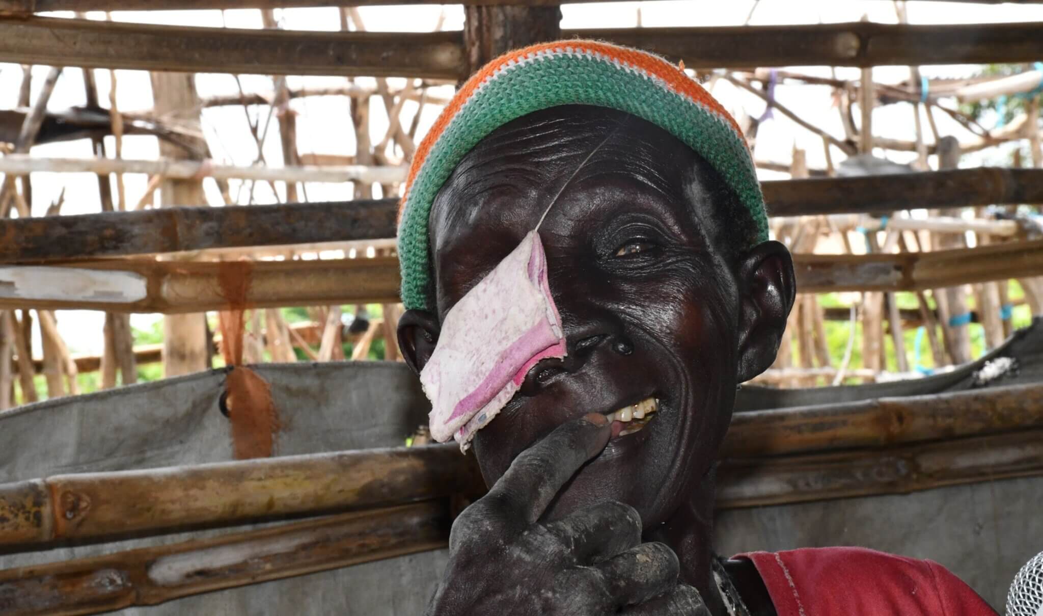 Mary Yar Madut smiles at the camera. She is wearing a striped hat and eye patch. Wooden structures are visible behind her. Mary is a farmer who used training and a grant from the We Are Able! programme to improve her crop yields and support her family.